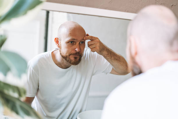istock Handsome bald man looking at mirror and touching face in bathroom 1412710169