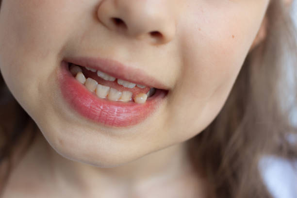 istock Baby teeth close-up. A child's smile 1412722245