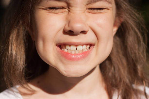 istock Baby teeth close-up. A child's smile 1412722339
