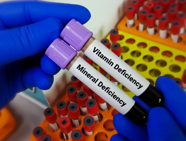 ученый держит два образца крови один заказ для теста на дефицит витаминов, другой - тест на де�фицит минералов с лабораторным фоном. - поражение стоковые фото и изображения