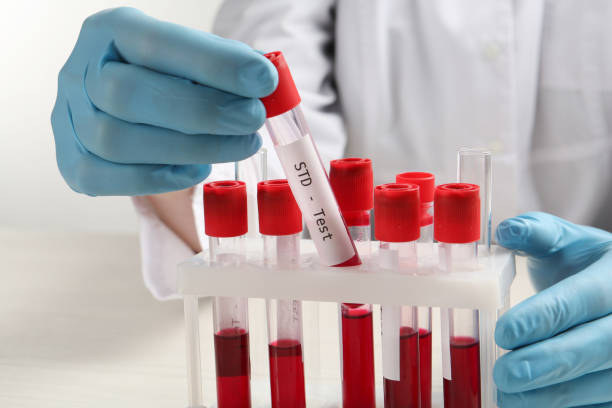 白いテーブルのラックから血液サンプルとラベルstdテストでチューブを採取する科学者、クローズアップ - scientist research group of people analyzing ストックフォトと画像