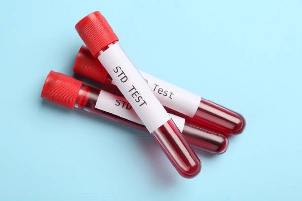tubes with blood samples and labels std test on light blue background, flat lay - sti imagens e fotografias de stock