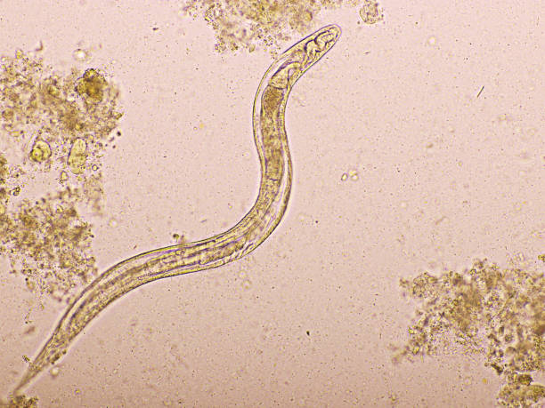 istock Strongyloides stercoralis in human stool 1413086272