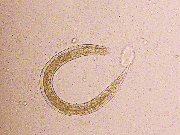 istock Strongyloides stercoralis in human stool 1413086274