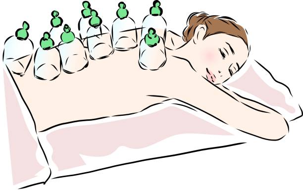 frau, die in einem schönheitssalon eine schröpftherapie erhält - acupuncture cupping stock-grafiken, -clipart, -cartoons und -symbole