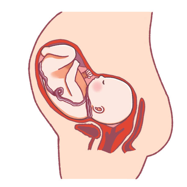istock The umbilical cord is wrapped around the fetus's neck. 1413210474