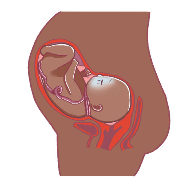 istock The umbilical cord is wrapped around the fetus's neck. 1413210488