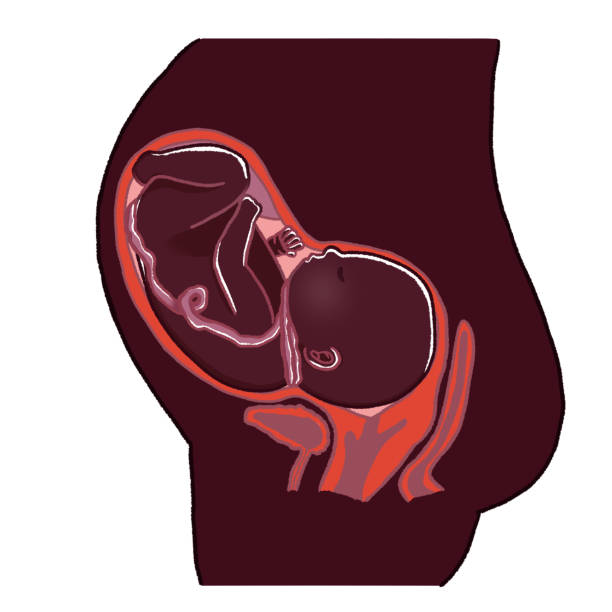 istock The umbilical cord is wrapped around the fetus's neck. 1413210493