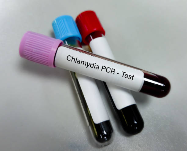 próbka krwi do testu pcr chlamydii lub reakcji łańcuchowej polimerazy dla chlamydii w celu wykrycia chorób przenoszonych drogą płciową. - sti zdjęcia i obrazy z banku zdjęć
