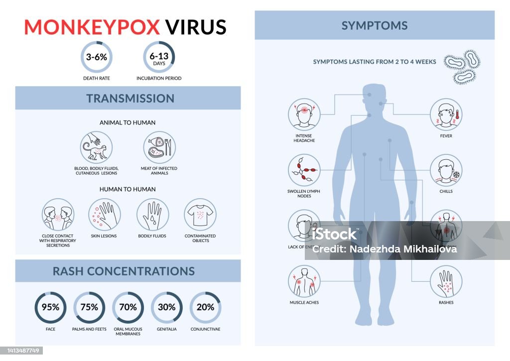 Monkeypox Process Monkeypox Virus Transmission And Symptoms Linear Vector Infographic ...