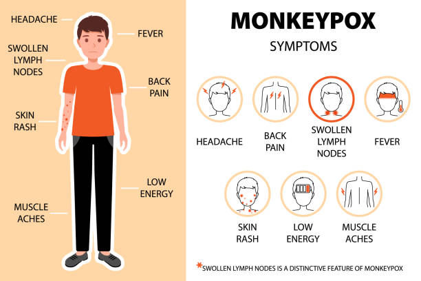 objawy wirusa ospy małpiej infografika z człowiekiem. ból głowy, ból pleców, obrzęk węzłów chłonnych, gorączka, wysypka skórna itp. ból głowy, ból pleców itp. nowe przypadki epidemii w europie i usa. - lymph node stock illustrations