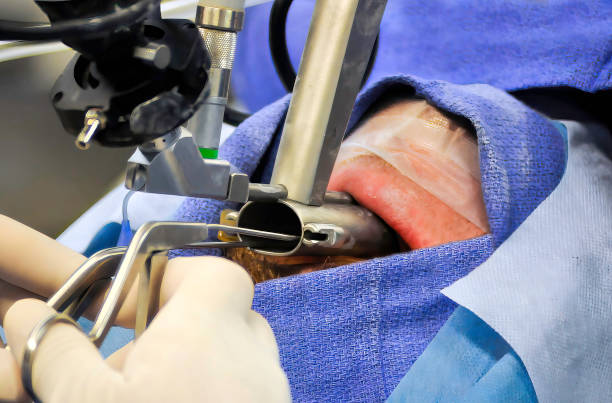 후두내시경 또는 성대 내시경 검사 - laryngoscopy 뉴스 사진 이미지