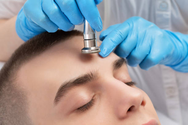 un cosmetólogo está haciendo el procedimiento microdermabrasión de la piel facial en un salón de belleza. cosmetología para hombres y cuidado profesional de la piel. - dermatology dermabrasion surgery medical fotografías e imágenes de stock