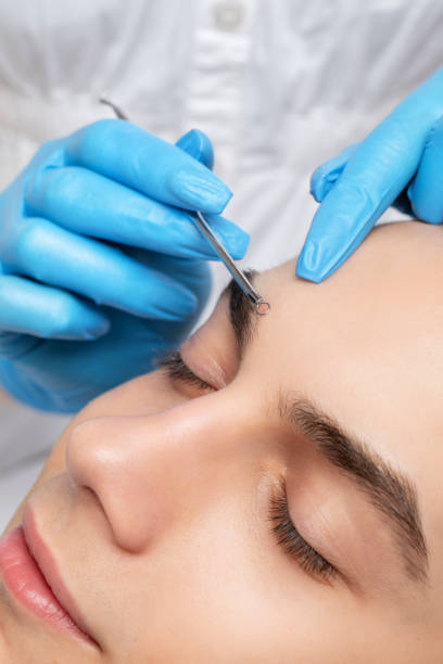 istock A young guy with problem skin on his face. Photos before and after acne treatment. 1413553406