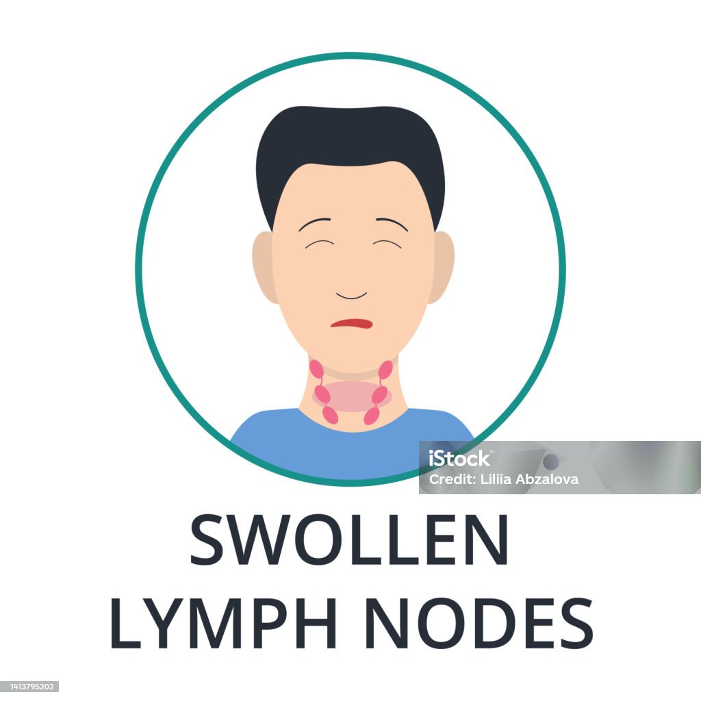 Man With Swollen Lymph Nodes Flu Coronavirus Monkeypox Symptoms Man With Swollen Lymph Nodes Flu Coronavirus Monkeypox Symptoms