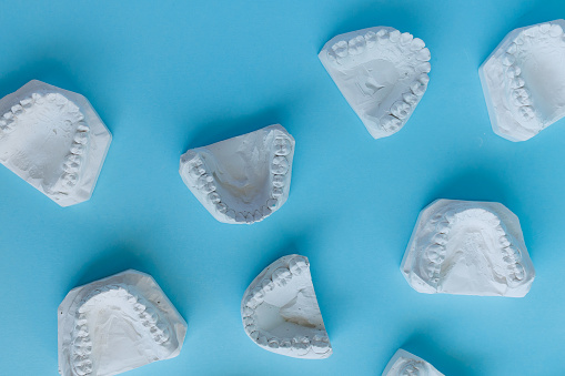 Top view of dental plaster casts of human teeth