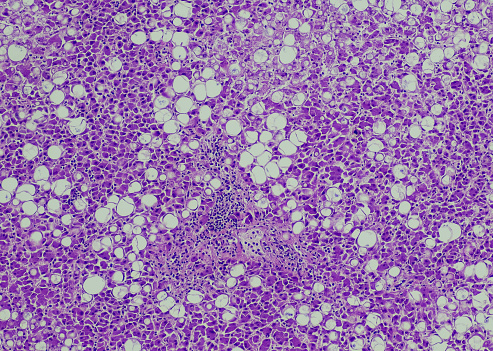 Host cells with spores (mold) are inside wood under the microscope for education.