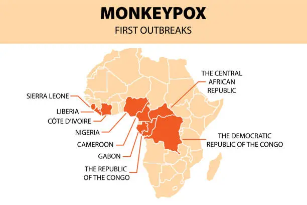 Vector illustration of Monkeypox virus infographic. African map of first outbreaks. New outbreak cases in Europe and USA.
