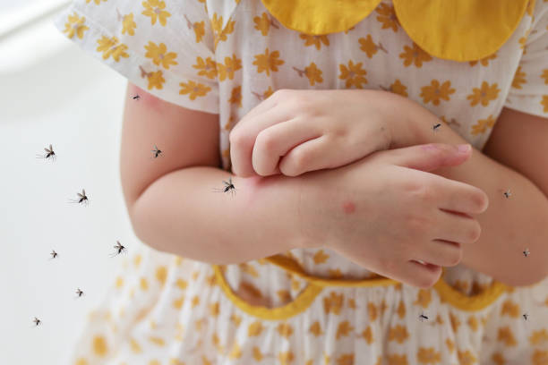 une petite fille a une allergie aux éruptions cutanées et des démangeaisons sur le bras à cause d’une piqûre de moustique - mosquito child bug bite scratching photos et images de collection
