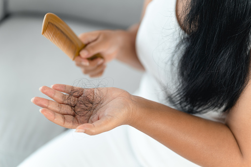 30k+ Hair Loss Pictures | Download Free Images on Unsplash 30k+ Hair Loss Pictures | Download Free Images on Unsplash