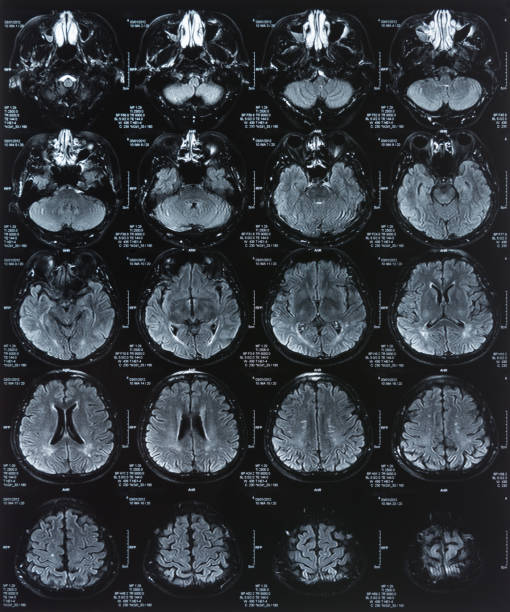 image cérébrale aux rayons x - 2655 photos et images de collection