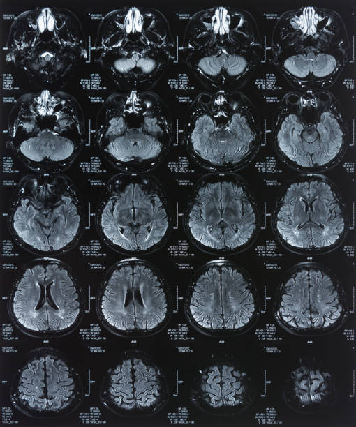 рентгеновское изображение головного мозга - brain mri scanner mri scan medical scan стоковые фото и изображения