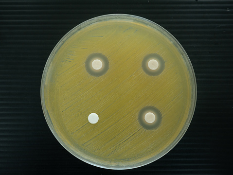 Close-up shot of a petri dish for checking clear zone an antibiotic in the laboratory.
