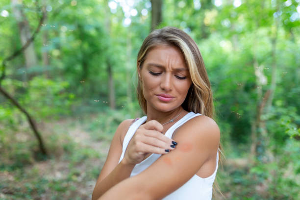 istock Itchy insect bite - Irritated young female scratching her itching arm from a mosquito bite at the park during summertime. 1414171780