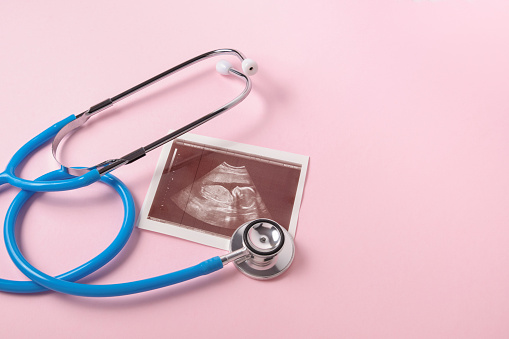 stethoscope and ultrasound scan of embryo on pink background, pregnancy concept