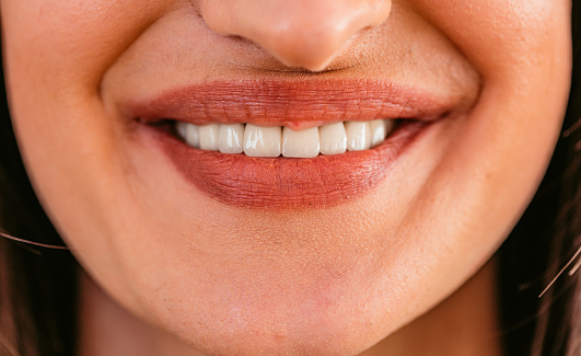 Cropped extreme-close-up shot of a young Caucasian woman with perfect white even teeth smiling pleasantly.