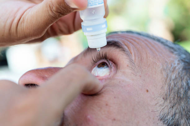 istock Man putting eye drops in an irritated eye 1414387331