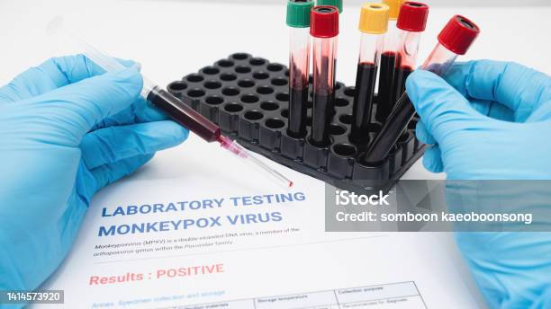 Monkeypox Lab Specimen Types Concept Detecting Monkeypox In The Laboratory Syringes Blood Sampling ...