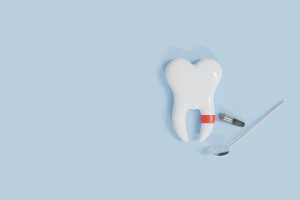 istock Dental implant concept, White teeth, and dental tools on blue background. 3d render. 1414603689