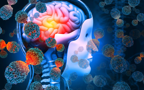 istock Brain cancer. Cancer cells attacking the human brain. 3d illustration 1414625531