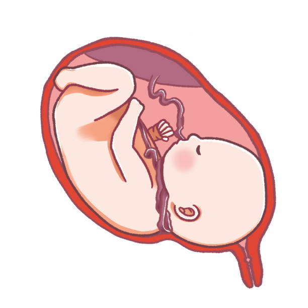 istock Nuchal cord; The umbilical cord is wrapped around the fetal neck. 1414742312