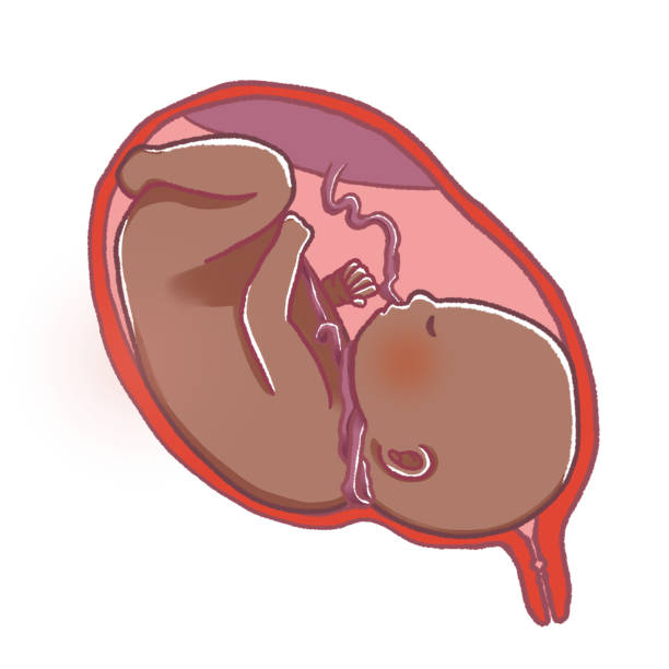 istock Nuchal cord; The umbilical cord is wrapped around the fetal neck. 1414742321