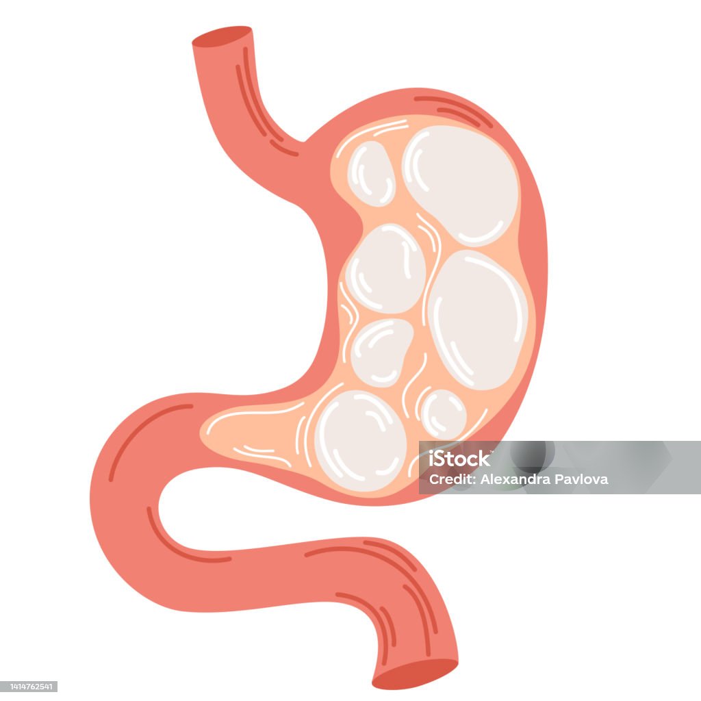 Bloating Heaviness In Stomach Gases Problem Gastritis And Acid Reflux bloating-heaviness-in-stomach-gases-problem-gastritis-and-acid-reflux