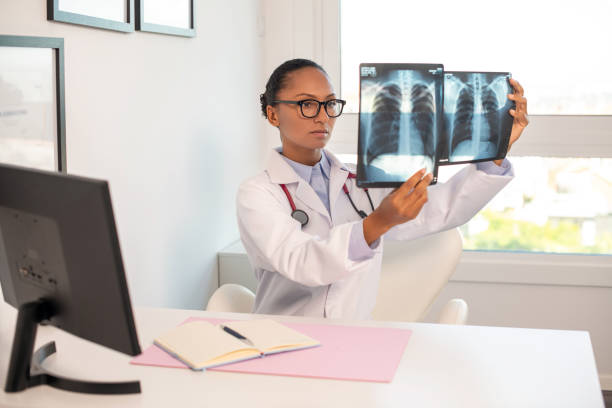 pneumologo serio che esamina le immagini a raggi x dei polmoni umani - human lung asthmatic x ray human internal organ foto e immagini stock
