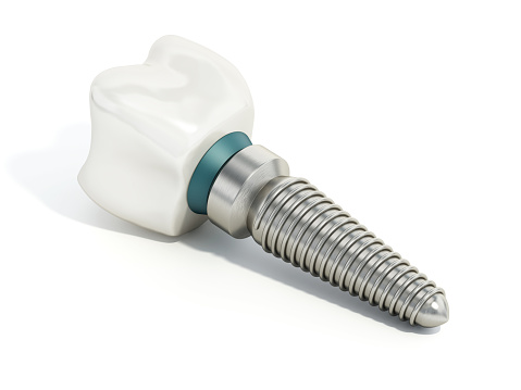 Titanium dental implant model isolated on white.