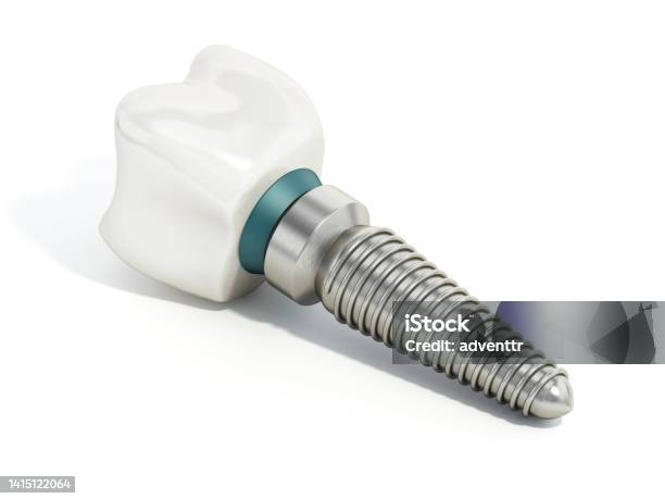 Titanium Dental Implant Model Isolated On White Stock Photo - Download Image Now - Dental Implant, Single Object, Implant