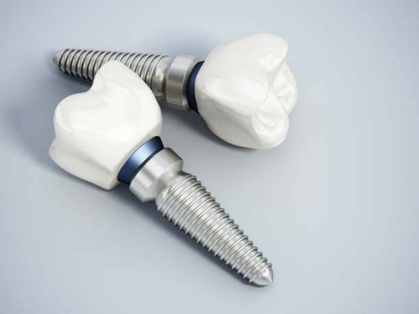 Titanium dental implant models stock photo