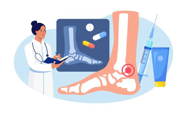 ilustraciones, imágenes clip art, dibujos animados e iconos de stock de artritis tobillo-pie. médico que examina imágenes de rayos x de las articulaciones. osteoartritis, artritis reumatoide, enfermedad de reumatismo. médico trata el dolor articular del paciente - osteoarthritis doctor medicine healthcare and medicine