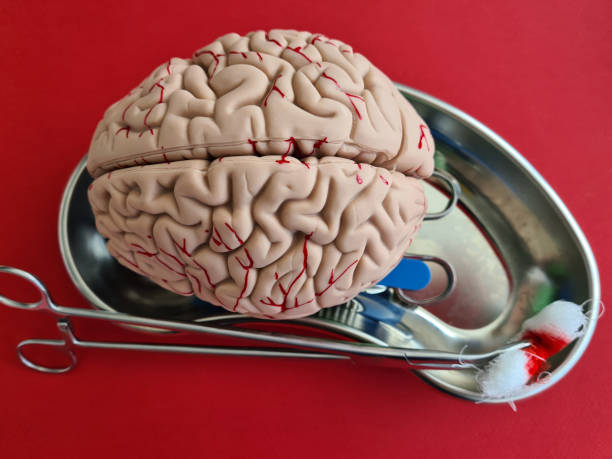 istock Brain anatomy models and surgical operations closeup 1415137991