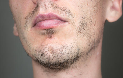 Barba corta y escasa en la cara del hombre. Problemas de crecimiento del cabello. Hombre con zona de alopecia en la barba. Cerdas sin afeitar en la barba. photo