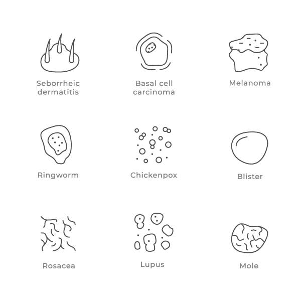 ilustrações de stock, clip art, desenhos animados e ícones de set line icons of skin disease - frieiras