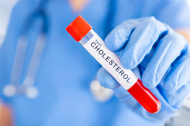 Nurse at the hospital holding a cholesterol blood sample tube Front closeup view of an unrecognizable nurse wearing surgical gloves holding a cholesterol blood test at the hospital. Selective focus is on the nurse hand. specimen holder stock pictures, royalty-free photos & images