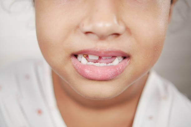 istock child girl with deformed teeth 1415499143