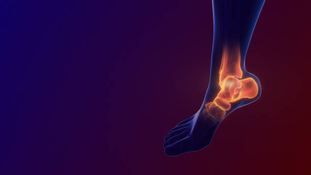 발목 관절의 통증 - 생체역학 뉴스 사진 이미지