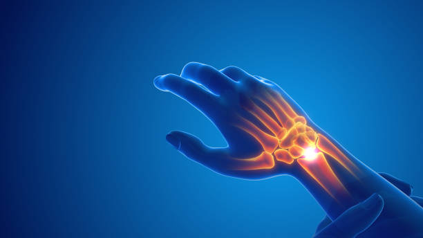 istock Pain in the wrist joint 1415553286
