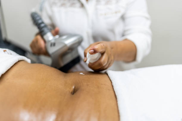 Aesthetician applying a cream to do a beauty treatment Aesthetician applying a cream to do a beauty treatment laser stretch marks stock pictures, royalty-free photos & images